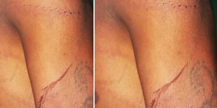 പെൺസുഹൃത്തിനെ കാണാൻ രാത്രിയിൽ മതിൽ ചാടിയെത്തി; 18കാരനെ കെട്ടിയിട്ട് മർദ്ദിച്ചു