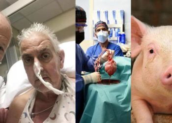 മനുഷ്യനില് ‘പന്നിയുടെ ഹൃദയം’ മിടിയ്ക്കുന്നു: ചരിത്രം രചിച്ച് വൈദ്യശാസ്ത്രം; മരണത്തില് നിന്നും രക്ഷിച്ചതിന് നന്ദി പറഞ്ഞ് ഡേവിഡ്