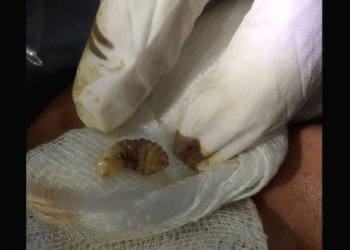 Botfly | Bignewslive