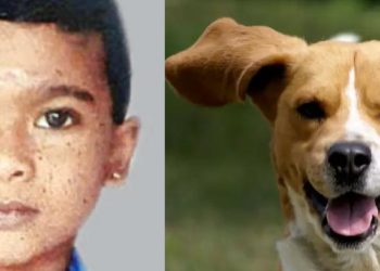 Dog bite | Bignewslive