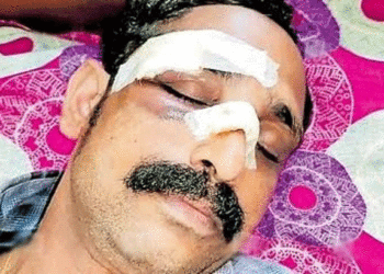 ബെല്ലടിച്ചിട്ടും ബസിൻ്റെ ഡോർ അടക്കാത്തതിനെ ചൊല്ലി യുവാവുമായി തർക്കം;കെഎസ്ആർടിസി ബസ് കണ്ടക്ടറെ ഇടിക്കട്ട കൊണ്ട് ആക്രമിച്ച് മൂക്കിൻ്റെ പാലം തകർത്തു