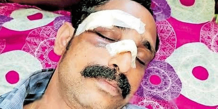 ബെല്ലടിച്ചിട്ടും ബസിൻ്റെ ഡോർ അടക്കാത്തതിനെ ചൊല്ലി യുവാവുമായി തർക്കം;കെഎസ്ആർടിസി ബസ് കണ്ടക്ടറെ ഇടിക്കട്ട കൊണ്ട് ആക്രമിച്ച് മൂക്കിൻ്റെ പാലം തകർത്തു