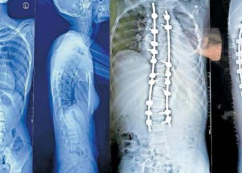 Backbone Cured | Bignewslive