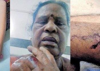 തെരുവ് നായ്ക്കള്‍ക്കു ഭക്ഷണം നല്‍കാനെത്തി: സീരിയല്‍ നടിയെ കടിച്ചു പറിച്ചു