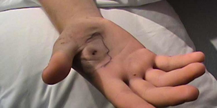 സാറേ പാമ്പ് കടിച്ചു; രക്ഷിക്കണം! കരിങ്കുന്നം പോലീസ് സ്റ്റേഷനില് അഭയം തേടി യുവാവ്; ഒടുവില് രക്ഷ