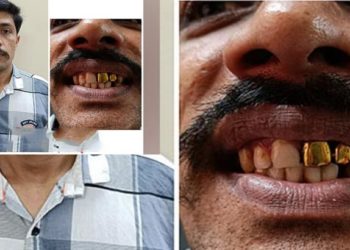 golden teeth | Bignewslive