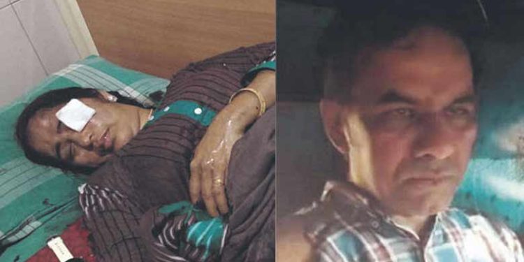 acid attack| bignewslive