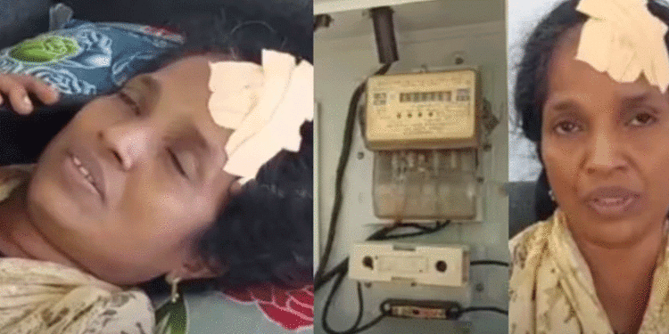 ടിവി കണ്ടുകൊണ്ടിരിക്കെ കരണ്ട് പോയി, ഫ്യൂസ് നോക്കാന് പോയപ്പോള് ഒളിച്ചിരുന്ന മോഷ്ടാവ് വീട്ടമ്മയുടെ തലക്കടിച്ചു, വീട്ടമ്മയ്ക്ക് പരിക്ക്