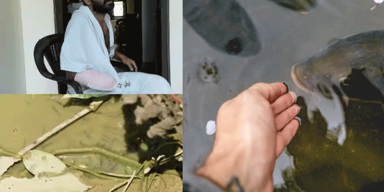 കുളം വൃത്തിയാക്കുന്നതിനിടെ കൈയ്യില്‍ മീന്‍ കൊത്തി, അണുബാധയെ തുടര്‍ന്ന് യുവാവിന്റെ വലത് കൈപ്പത്തി മുറിച്ചുമാറ്റി