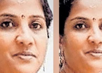 ചൂരമീൻ കറി കഴിച്ചതിന് പിന്നാലെ നിർത്താതെ ഛർദ്ദി, ബാങ്ക് ജീവനക്കാരി മരിച്ചു