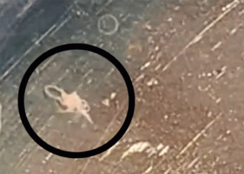 ഒറ്റപ്പാലത്ത് മൂന്നര വയസുകാരിയുടെ കണ്ണില്‍ നിന്നും സര്‍ജറിയിലൂടെ വിരയെ നീക്കം ചെയ്തു, ശസ്ത്രക്രിയ പൂര്‍ണ വിജയം