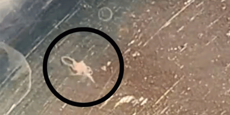 ഒറ്റപ്പാലത്ത് മൂന്നര വയസുകാരിയുടെ കണ്ണില്‍ നിന്നും സര്‍ജറിയിലൂടെ വിരയെ നീക്കം ചെയ്തു, ശസ്ത്രക്രിയ പൂര്‍ണ വിജയം