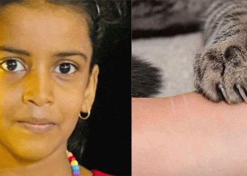 വളര്‍ത്തു പൂച്ചയുടെ ആക്രമണത്തില്‍ പരിക്കേറ്റ് ചികിത്സയിലായിരുന്ന പെണ്‍കുട്ടി മരിച്ചു