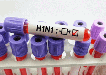 കൊല്ലത്ത് 4 വിദ്യാർത്ഥികൾക്ക് എച്ച് 1 എൻ 1 സ്ഥിരീകരിച്ചു