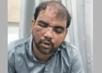 ടിക്കറ്റും തിരിച്ചറിയൽ രേഖകളും ആവശ്യപ്പെട്ട് ടിടിഇ, ഓടുന്ന ട്രെയിനിൽ നിന്ന് പുറത്തേക്ക് ചാടിയ ശീതളപാനീയ കച്ചവടക്കാരന് പരിക്ക്