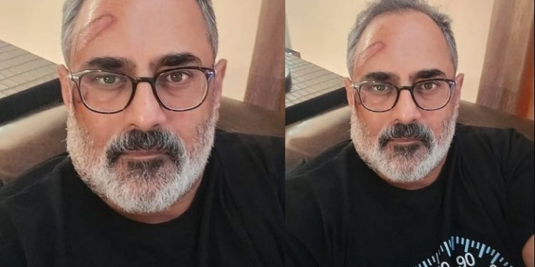 ട്രെഡ് മില്ലില് നിന്നു വീണു, രാജീവ് ചന്ദ്രശേഖറിന് പരിക്ക്