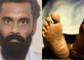 കുടുംബവഴക്ക്, ഭര്‍ത്താവ് വെട്ടിപ്പരിക്കേല്‍പ്പിച്ച യുവതി മരിച്ചു