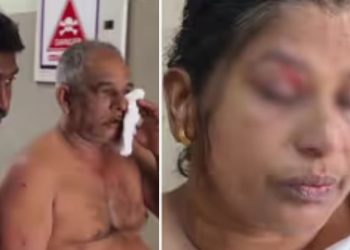 കുറുനരിയുടെ ആക്രമണം, ദമ്പതികൾക്ക് പരിക്ക്